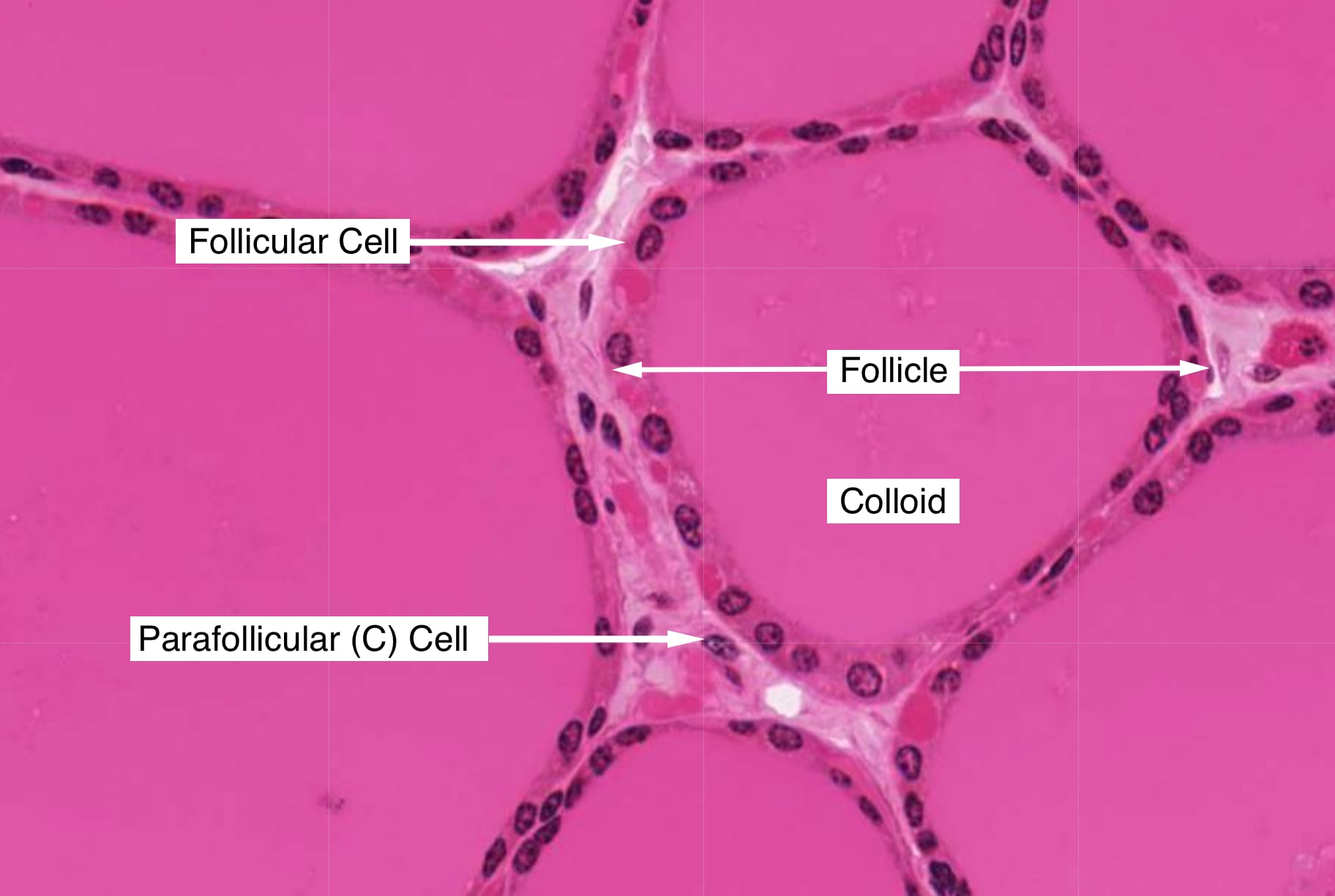 Follicles are defined by a layer of epithelial cells called follicular cells.