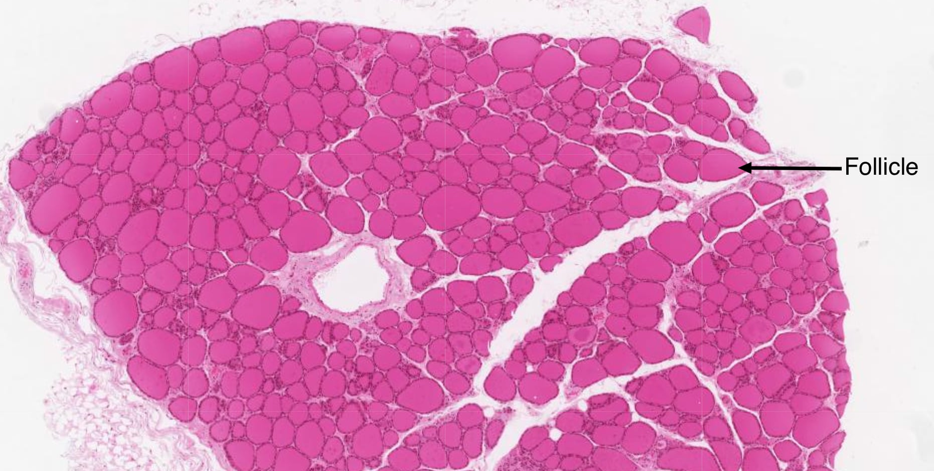 The thyroid is composed of numerous follicles that store inactive hormone in colloid.